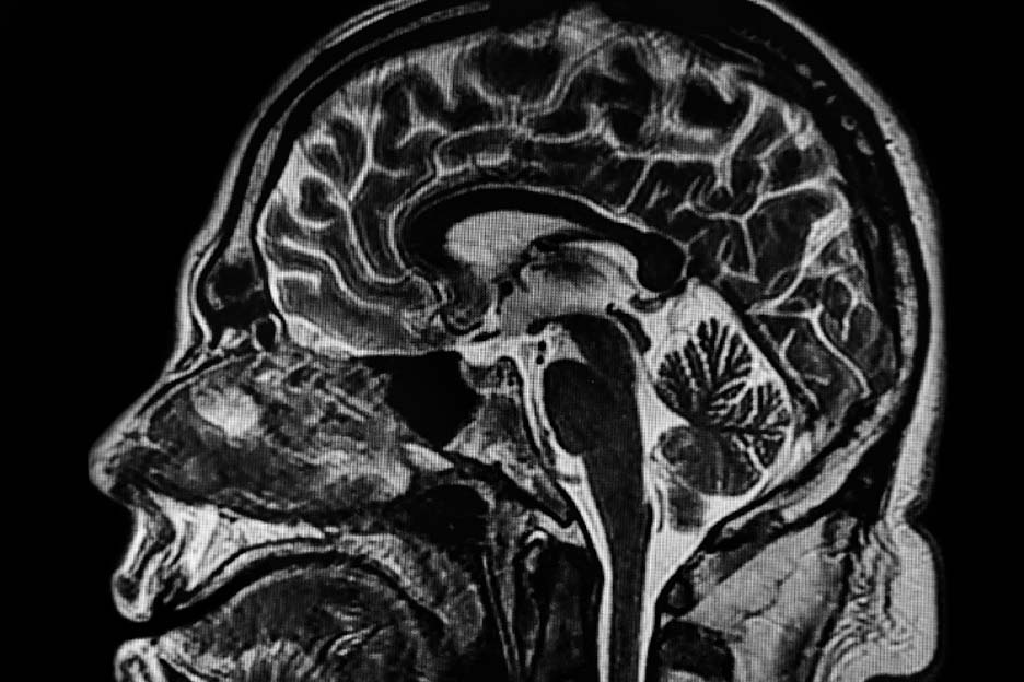 CT Scans